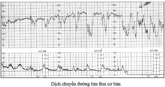 Đo monitor trong thai kỳ có ý nghĩa gì?