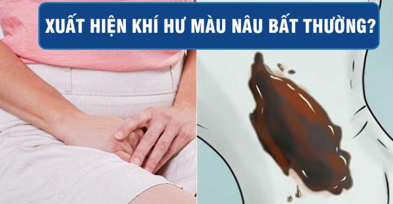 Khí hư màu nâu - Nguyên nhân và cách khắc phục